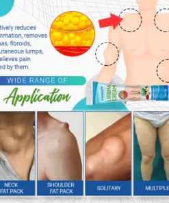 Cvreoz Lipoma Removal Cream