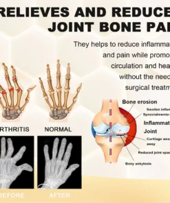 Cvreoz™ Bee Venom Pain and Bone Healing Essential oil