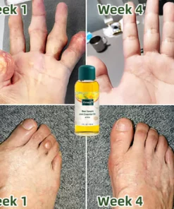 Cvreoz™ Bee Venom Pain and Bone Healing Essential oil