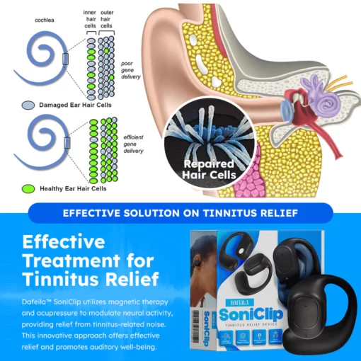 Dafeila™ SoniClip Tinnitus Relief Apparat