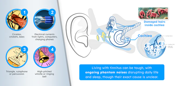 Dafeila™ SoniClip Tinnitus Relief Device