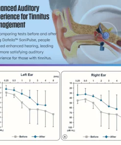 Dafeila™ SoniPulse Tinnitus Relief Soothing Aid