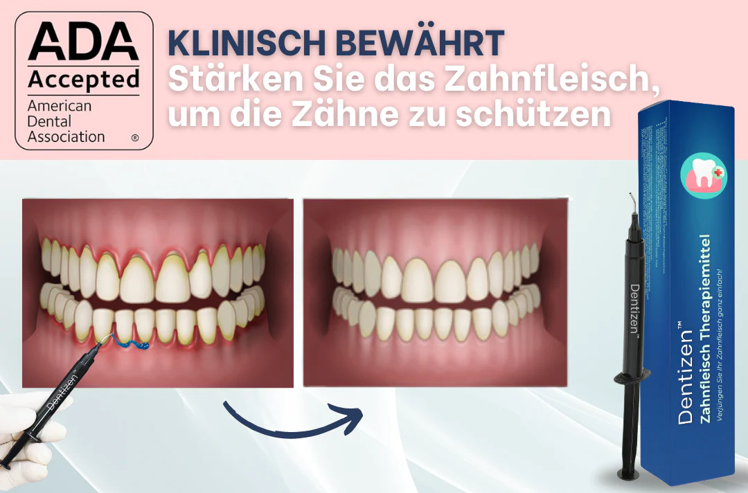 Dentizen™ Zahnfleisch Therapiemittel