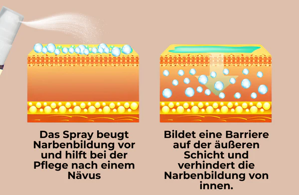 DermActiv™ Nävus Entfernungsset