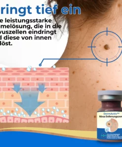 DermActiv™ Nävus Entfernungsset