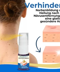 DermActiv™ Nävus Entfernungsset