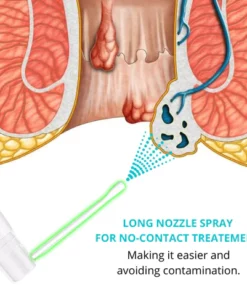 Dobshow™ Natürliches Kräuter-Hämorrhoiden-Spray