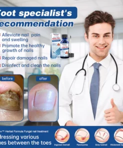 Dobshow™ Herbal Formula Fungal nail Paronychia treatment Gel