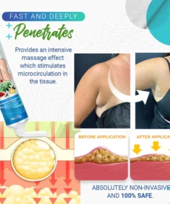 Dobshow™ Lipoma Removal Cream