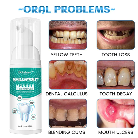 Dobshow™ SmileBright Mousse