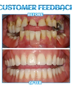 Dobshow™ SmileBright Mousse