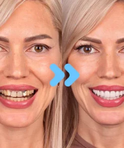 Dobshow™ SmileBright Mousse