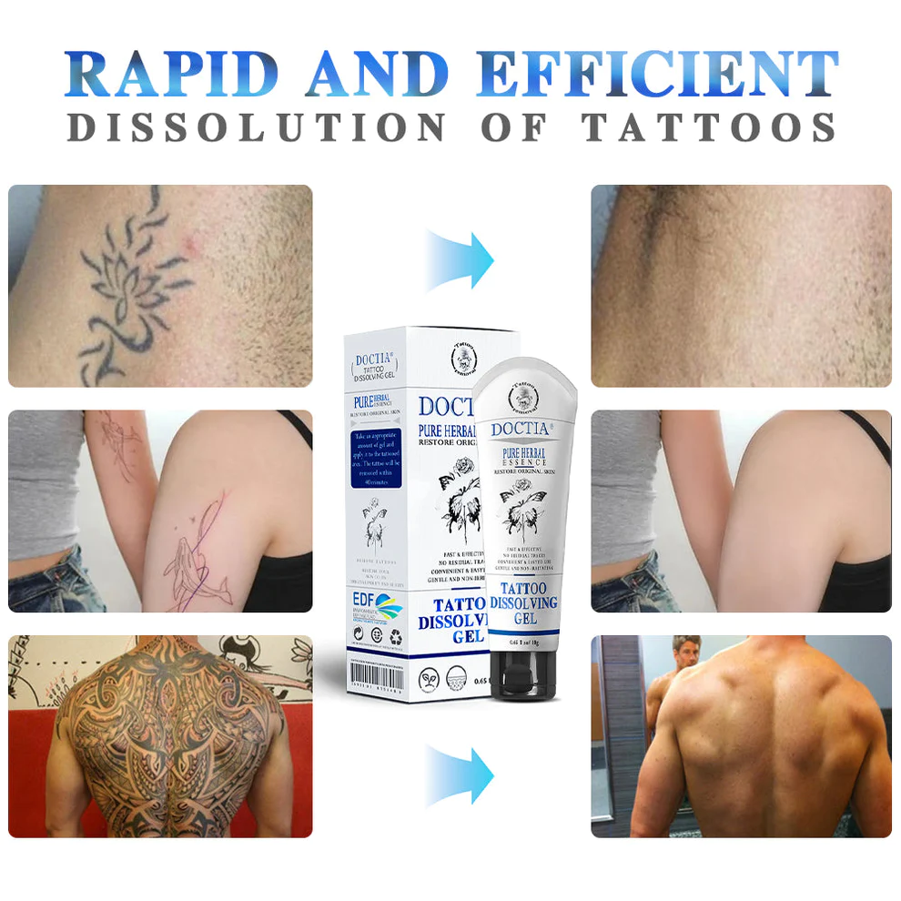 Canadian Student Develops Pain-Free Tattoo Removal Cream - Health & Sports  News