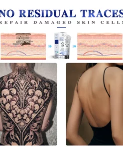 Doctiat™ Tattoo Removal Cream