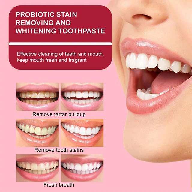 Dr. Smile SP-4TM Probiotic Rapid Whitening Toothpaste