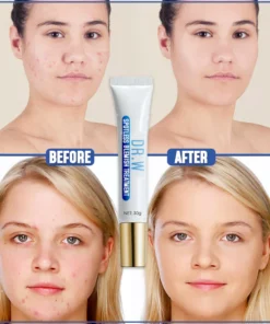 Dr. W Spotless Blemish Treatment