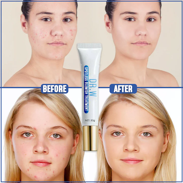 Dr. W Spotless Blemish Treatment