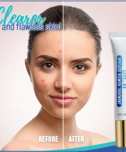 Dr. W Spotless Blemish Treatment