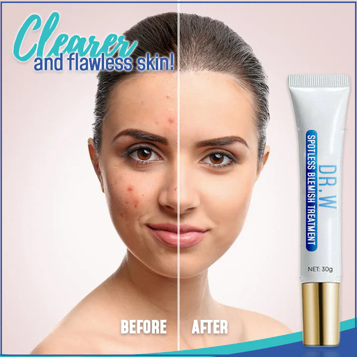 Dr. W Spotless Blemish Treatment