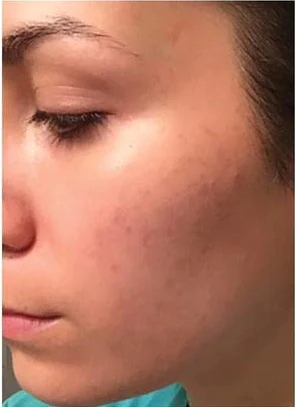 Dr.Rashel™ Niacinamide Cream Day Whitening