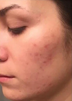 Dr.Rashel™ Niacinamide Cream Day Whitening