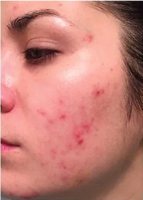 Dr.Rashel™ Niacinamide Cream Day Whitening
