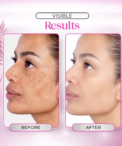 Dr.Rashel™ Niacinamide Whitening Day Cream