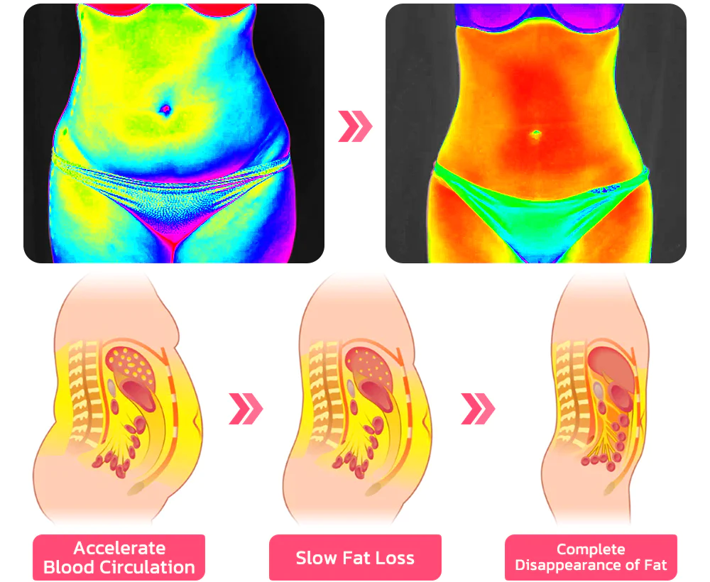 FANCYSTAR™ Negative Ionization Tummy Control Therapy & Detox Bodysuit