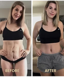 FANCYSTAR™ Sodium IonFiber Restoration Shaping Bodysuit