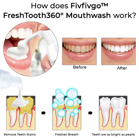 Fivfivgo™ FreshTooth360° Mundwasser
