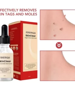 Fivfivgo™ SkinClear Sildid ja Maulwurfsentferner