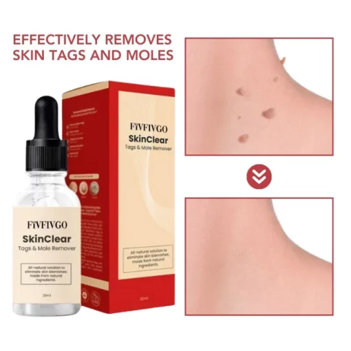 Fivfivgo™ SkinClear Sildid ja Maulwurfsentferner