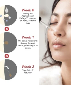 Fivfivgo™ SkinClear Sildid ja Maulwurfsentferner