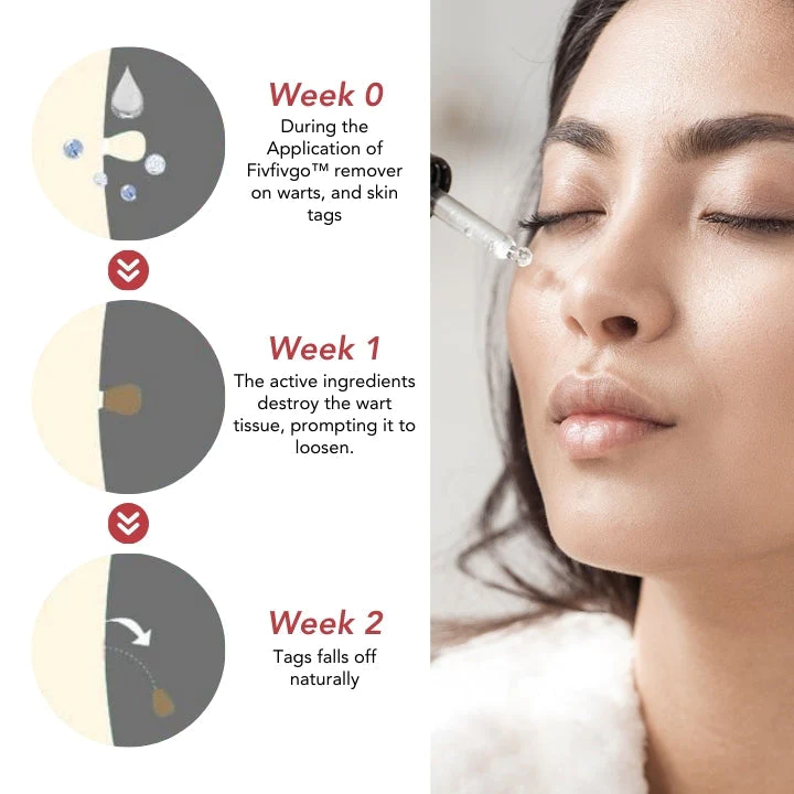 Fivfivgo™ SkinClear Sildid ja Maulwurfsentferner
