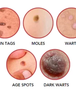 Fivfivgo™ SkinClear Sildid ja Maulwurfsentferner