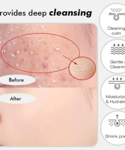 Fivfivgo™ Aufhellendes Haut-Peeling-Gel auf Kräuterbasis