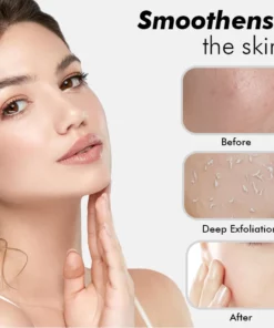 Fivfivgo™ Aufhellendes Haut-Peeling-Gel auf Kräuterbasis