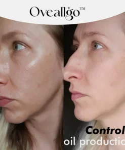 Fivfivgo™ Aufhellendes Haut-Peeling-Gel auf Kräuterbasis