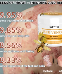 Fivfivgo™ BeeVenom Psoriasis-Lösungs-Creme