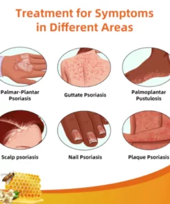 Fivfivgo™ BeeVenom Psoriasis-Lösungs-Creme