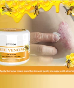 Fivfivgo™ BeeVenom Psoriasis-Lösungs-Creme