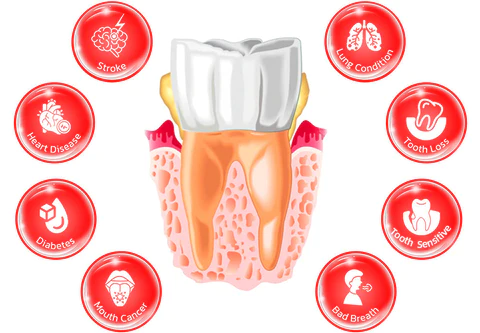 Fivfivgo™ Bequemer Zahnfleischschutz in Pellets