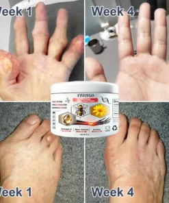 Fivfivgo™ Bienengift Ballenentzündung Creme