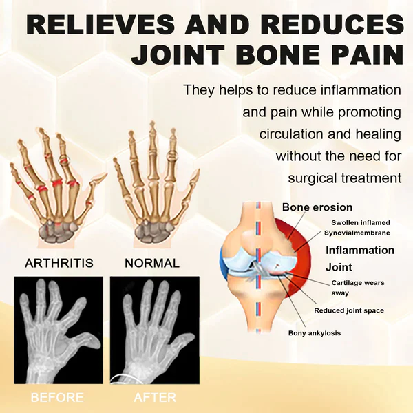 Fivfivgo™ Bienengift Schmerz- und Knochenheilungsspray