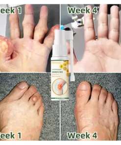 Fivfivgo™ Bienengift Schmerz- und Knochenheilungsspray