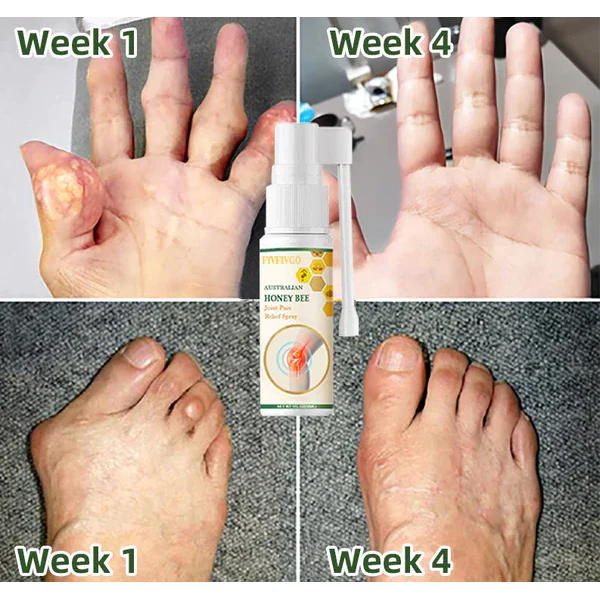 Fivfivgo™ Bienengift Schmerz- und Knochenheilungsspray