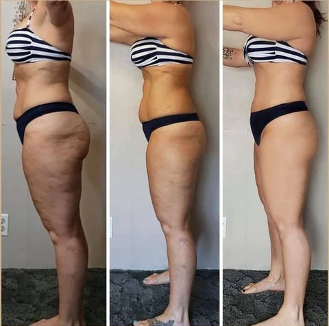 Fivfivgo™ Collagen Boost Straffendes & Lifting-Pflegeöl