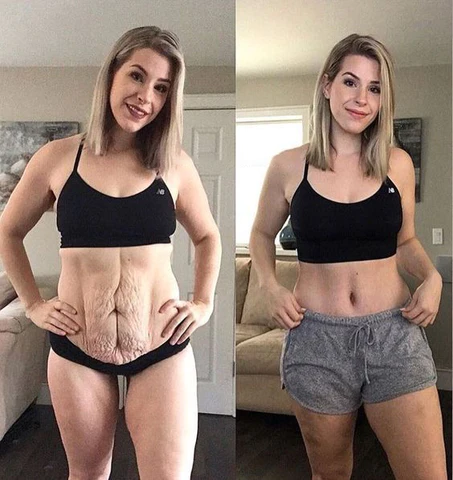 Fivfivgo™ Collagen Boost Straffendes & Lifting-Pflegeöl