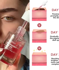 Fivfivgo™ Dunkler Fleck Niacin 10% Korrigierendes Serum