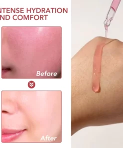 Fivfivgo™ Dunkler Fleck Niacin 10% Korrigierendes Serum